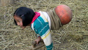Национальная героиня Китая: девочка с баскетбольным мячом вместо ног стала известной спортсменкой