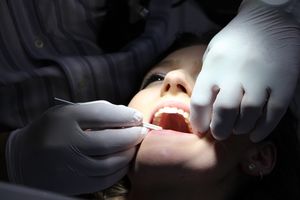 Нутрициолог рассказала способ спасти зубы от разрушения