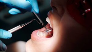 Стоматолог предупредила об опасности болезней рта для внутренних органов