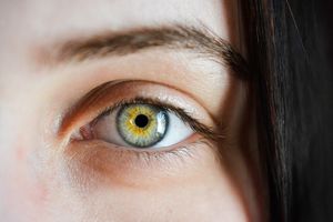 Названы три признака заболевания глаз, указывающие на повышенный холестерин