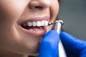 Ошибки, которые нужно избегать во время чистки зубов