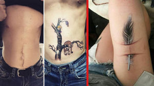 42 татуировки, которые превратили шрамы в произведение искусства