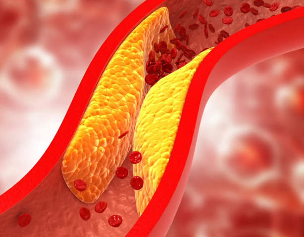 Статины и холестерин: польза, показания и возможные риски
