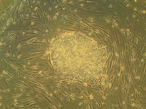 Прорыв в репродуктивной медицине: стволовые клетки снизят бесплодие