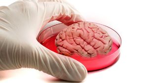 Ученые вырастили в чашке Петри мини-мозг