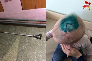 В Новосибирске подростки разбили младенцу голову лопатой, отцу ребенка грозит уголовное дело