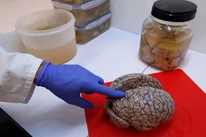 В мозге обнаружен источник человеческого сознания
