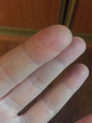 Мужчины внезапно обнаружили необъяснимые шрамы на указательных пальцах