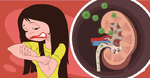 8 симптомов, которые свидетельствуют о заболевании почек