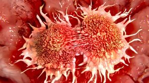 Новая технология позволяет обнаружить рак легких на самой ранней стадии