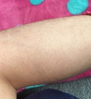 Британка удалила волосы на ногах шестилетней дочки по совету пользователей Сети