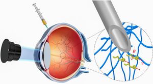 Нанороботов для лечения заболеваний впервые ввели в человеческий глаз