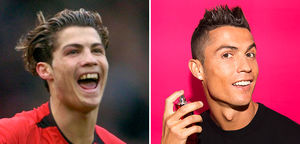 Известный футболист Криштиану Роналду: до и после пластики