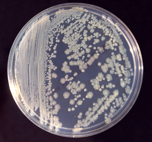 НАСА сообщает, что МКС захватили штаммы опасных для людей бактерий