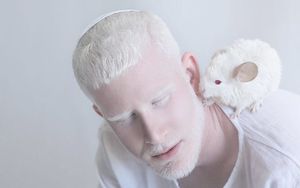 Волшебная красота людей-альбиносов в фотопроекте израильского фотографа