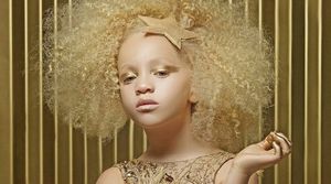 8-летняя афроамериканка-альбинос стала сенсацией в мире моды — Eщё