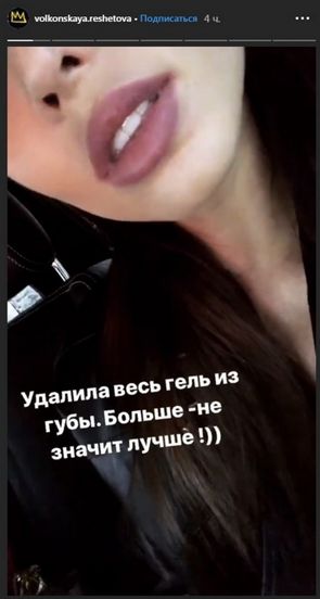 Анастасия Решетова уменьшила губы, выкачав из них весь гель