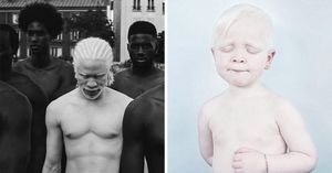 Фотографы запечатлели уникальную красоту альбиносов, и она покорила уже не одно сердце