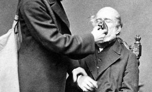 Тайны истории: 10 шокирующих фактов о викторианской хирургии