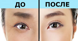 Эффективная техника омоложения ШИАЦУ: Всего 1 минута в день для красоты глаз!