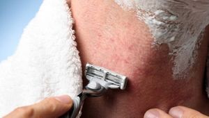 Простые способы убрать раздражение после бритья
