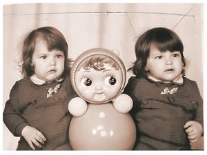 Как живут сейчас первые удачно разделенные в СССР сиамские близнецы