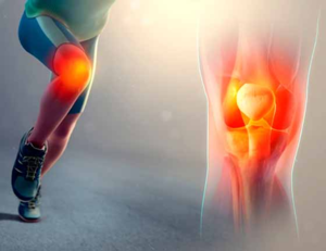 Народная медицина: Что делать если болит колено?