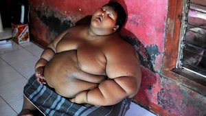 Самый тяжелый ребенок в мире похудел
