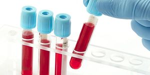 Учёные установили, кокой группе крови не страшен рак