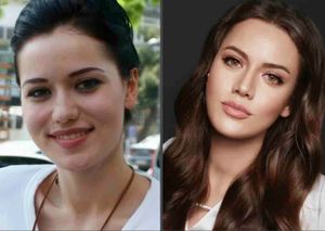 «Это всё гены! И немного пластики!», — турецкие актрисы до и после