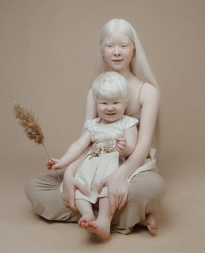 Сёстры-альбиносы родились с разницей в 12 лет и покорили мир моды своей уникальностью необычной внешностью.