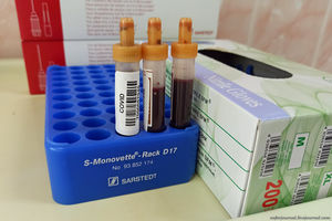 В поликлиниках начали делать бесплатные тесты на антитела к коронавирусу