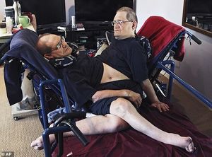 В США умерли самые старые сиамские близнецы Ронни и Донни Гэлион
