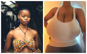 Как камень с души: жизнь девушки с 13 размером груди кардинально изменилась после операции по уменьшению бюста