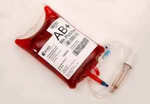 Кровь с каким резус-фактором является самой ценной в мире