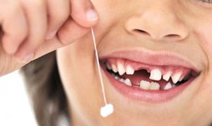 10 самых странных фактов о зубах
