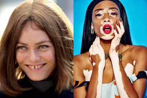 5 знаменитостей, которых мы любим, несмотря на дефекты их внешности