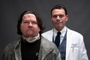 Пострадавшему в аварии американцу впервые в мире пересадили лицо и обе руки