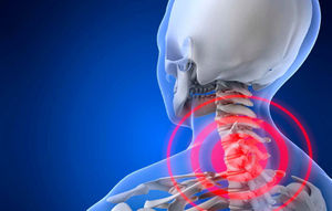 Шейный остеохондроз: симптомы и лечение