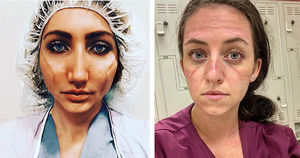 «Эти раны не пройдут — они останутся внутри нас»: фото девушек-медиков со следами от масок на лицах