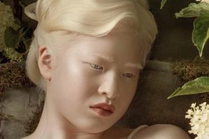 Выброшенная матерью альбиноска Сюэли