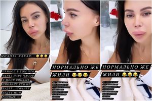 Странные губы Оксаны Самойловой