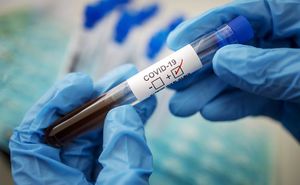 Где сегодня можно сдать достоверный тест на коронавирус?