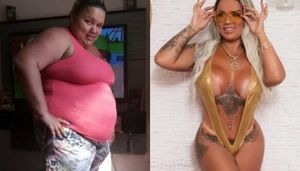 Молодая мать из Бразилии за два года похудела на 70 кг и стала успешной моделью