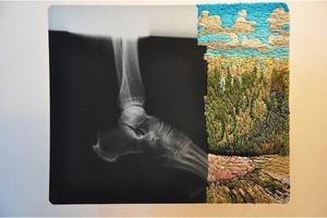 Мэтью Кокс превращает рентгеновские снимки в искусство