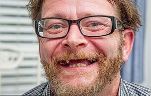 Зубная боль — это не шутка: британец оказал себе помощь сам
