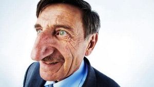 Буратино в реальной жизни: человек с самым длинным носом в мире