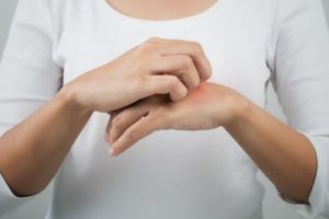 Аллерголог объяснила, как может возникнуть аллергия на мужа