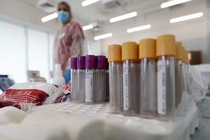 Разведка США опубликовала доклад о происхождении коронавируса