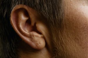 Врачи сообщили о частых проблемах со слухом у пациентов с коронавирусом